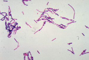 Bacillus cereus gram stain  Image/CDC 