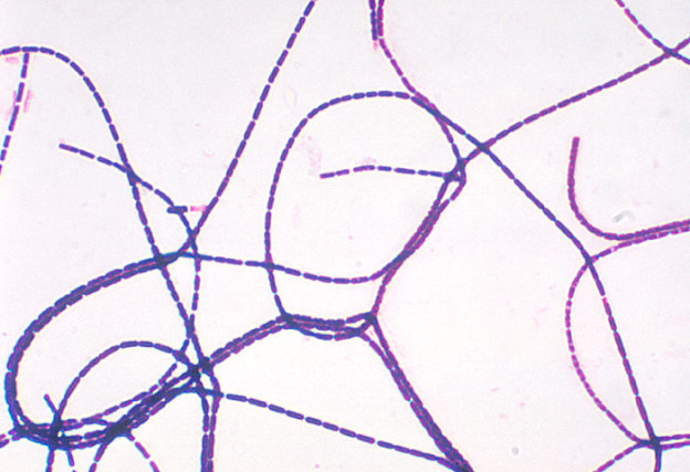 Bacillus anthracis gram stain Image/CDC