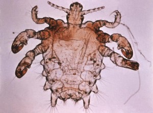Phthirus pubis, or more commonly known as the pubic or crab louse Image/CDC
