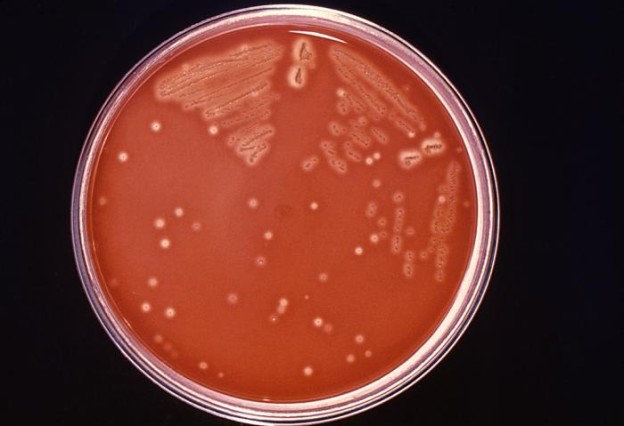 Streptococcus pyogenes on Sheep blood agar Image/ CDC