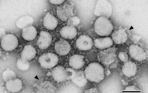 Severe acute respiratory virus (SARS) virions Image/CDC