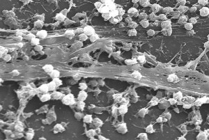 Bacterial biofilm Image/CDC