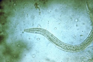 Hookworm Image/CDC