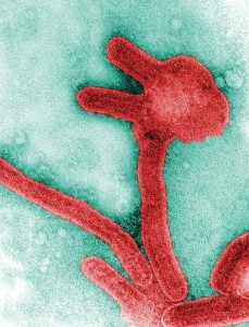 Marburg virus Image/CDC