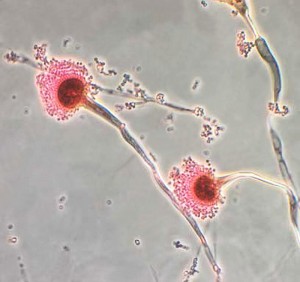 Aspergillus fumigatus/CDC