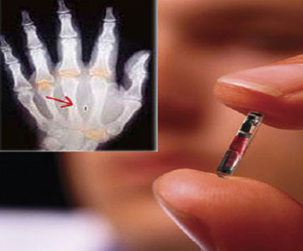 Screenshot from the NBC coverage of microchip technology in the human hand