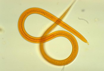 Strongyloides filariform larva/CDC