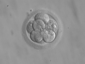 Human embryo, 8 cells on day 3 photo: ekem, Courtesy: RWJMS IVF Program via wikimedia commons